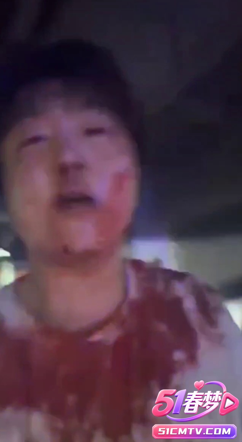 抖音富二代赵俊逸车库惨遭精神小伙群殴 满脸鲜血视频曝光 炫富遭重锤太惨！