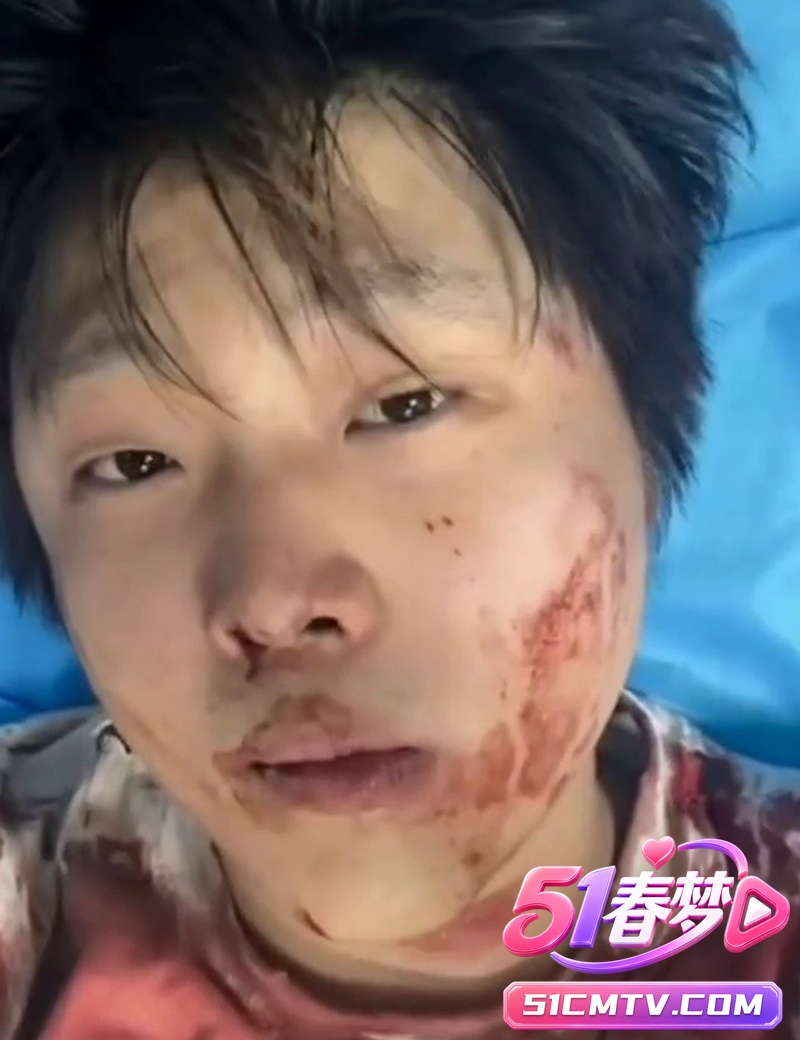 抖音富二代赵俊逸车库惨遭精神小伙群殴 满脸鲜血视频曝光 炫富遭重锤太惨！
