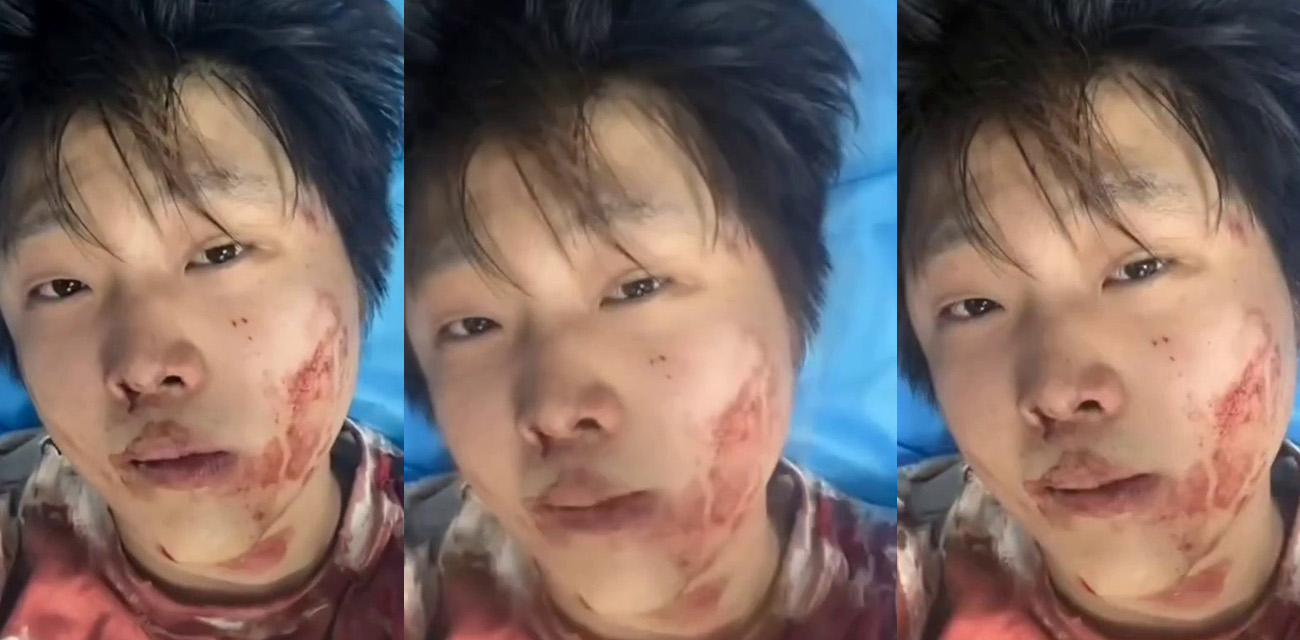 抖音富二代赵俊逸车库惨遭精神小伙群殴 满脸鲜血视频曝光 炫富遭重锤太惨！